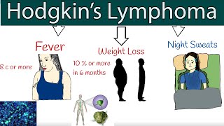 Hodgkins lymphoma Hodgkins disease  Symptoms and treatment How to detect lymphoma [upl. by Yortal]