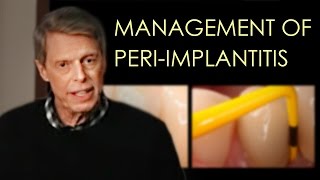 Management of Periimplant Disease Updated [upl. by Nesta]