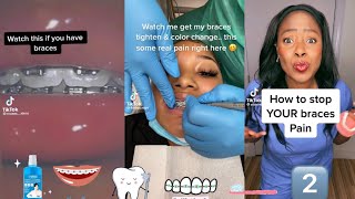 Braces Tips pt2 TikTok Compilation [upl. by Soinski744]