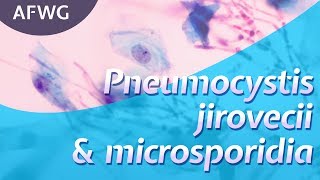 Latest on P jirovecii microsporidia – Prof D Marriott [upl. by Lantha]