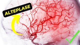 Alteplase Understanding its Mechanism of Action and Potential Side Effects [upl. by Doyle]