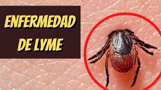 ENFERMEDAD DE LYME síntomas diagnóstico tratamiento y prevención [upl. by Ridan]