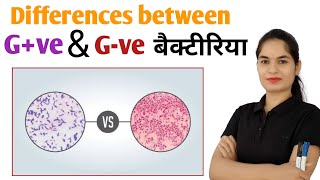 Differences between Gram positive and Gram negative bacteria  Gram positive vs Gram negative [upl. by Cirdec121]