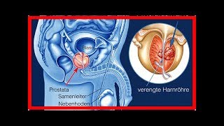 Forschern gelingt Durchbruch bei der Behandlung von Prostatakrebs [upl. by Chow]