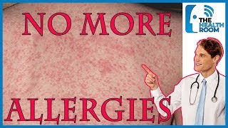 Top 10 HOME REMEDIES to Cure SKIN ALLERGIES NATURALLY [upl. by Brina444]