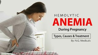 Hemolytic Anemia during Pregnancy  Full Explanation in Hindi  By NG Medicals [upl. by Uv]