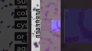 Lets Review Corynebacterium Diphtheriae shorts 😷🤔 [upl. by Teufert]