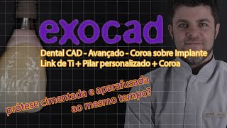 EXOCAD  Como fazer o melhor tipo de prótese sobre implante DICA FINAL IMPORTANTE [upl. by Htebasyle]