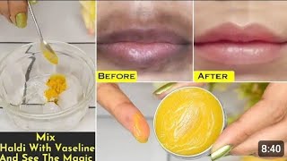 pigmented lips treatment  7day challenge to change lip color  dark lips treatment [upl. by Masson]