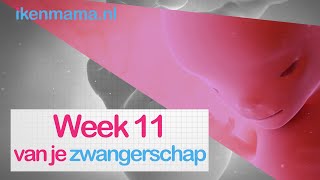 11 weken zwanger  ikenmamanl [upl. by Bravin]