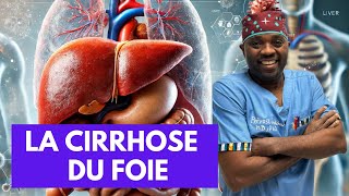 Tout ce que vous devez savoir sur La cirrhose du foie par docteursourire [upl. by Gelasias638]