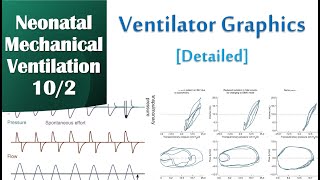 Neonatal Mechanical Ventilation 102  Graphics detailed [upl. by Arannahs]