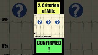 2 simple ECG criteria of ATRIAL FIBRILLATION [upl. by Ellehcram944]