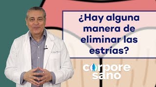 ¿Hay alguna manera de eliminar las estrías  Corpore Sano [upl. by Pacifica323]