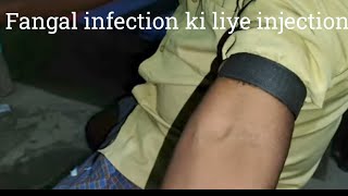 fangal infection in hindi [upl. by Weksler]