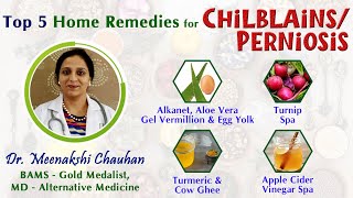 Top 5 Home Remedies for Chilblains Perniosis Natural Treatment [upl. by Atteugram]