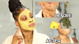 I TRIED GLEAMIN FACE MASK FOR 7 DAYS  DOES GLEAMIN VITAMIN C CLAY MASK WORK FOR HYPERPIGMENTATION [upl. by Anselmo]