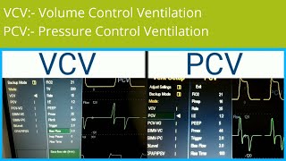 Ventilator settings  VCV vs PCV  Volume Control Ventilation VS Pressure Control Ventilation [upl. by Aitropal]