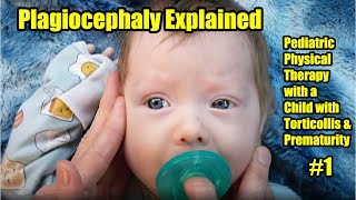 1 Plagiocephaly Explained Pediatric Physical Therapy with a Child with Torticollis amp Prematurity [upl. by Eiliab]