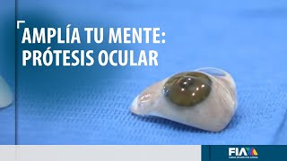 AMPLÍA TU MENTE  La prótesis ocular regresa la esperanza a pacientes que han perdido un ojo [upl. by Addam625]