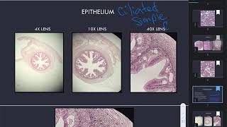 Ciliated Simple Columnar and Ciliated Pseudostratified Columnar Epithelium [upl. by Doe]