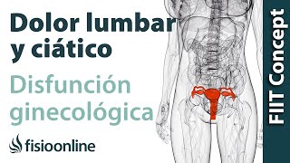 Disfunciones ginecológicas y dolor de espalda lumbar y ciático  Causas y tratamiento [upl. by Maurita]