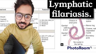 Lymphatic filariasis microbiology labdiagnosis [upl. by Marduk4]