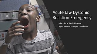 Acute Jaw Dystonic Reaction Emergency [upl. by Iblehs514]