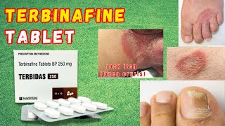 Terbinafine Tablet  Terbinafine Antifungal Drug  Terbinafine Tablets ip 250 mg [upl. by Hewe285]