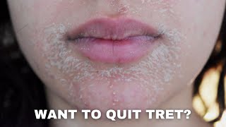 WATCH THIS BEFORE QUITTING RETINA  PURGING DRYNESS ACNE AND ANTIAGING [upl. by Eemyaj313]