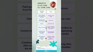 Amniotic fluid leakvs urine leak [upl. by Enyad983]