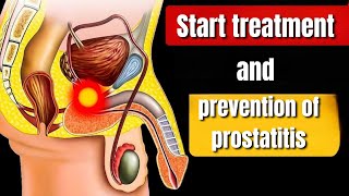 Effective Treatment and Prevention Tips for Prostatitis A Comprehensive Guidequot [upl. by Anirtap]