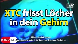 Ecstasy frisst Löcher in dein Gehirn  Schau es dir an [upl. by Nolyaw]