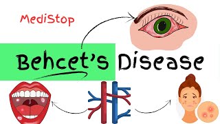 Behcets Disease explained  Signs amp Symptoms Diagnosis Treatment [upl. by Leffert]