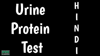 Protein Urine Test Hindi  Urine Protein Test Kya Hota Hai  Total Protein Urine Test [upl. by Stannwood178]