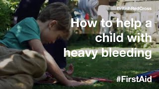 How to help a child with heavy bleeding FirstAid PowerOfKindness [upl. by Maurili237]