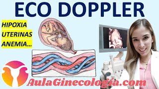 ECO DOPPLER EN OBSTETRICIA HIPOXIA ARTERIAS UTERINAS ANEMIA FETAL  Ginecología y Obstetricia [upl. by Attevaj943]