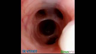 Canine Bronchiectasis by using EU140H [upl. by Argyres545]