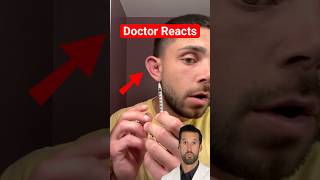 ER Doctor REACTS to Draining Cauliflower Ear [upl. by Gebhardt]