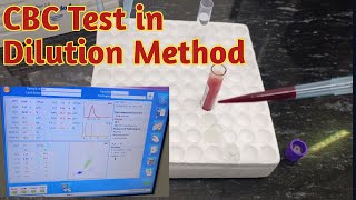 cbc dilution method  cbc manual procedure [upl. by Aenahs151]