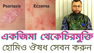 একজিমা রোগে হোমিও ঔষধ। Dr M A Jabber [upl. by Joon]