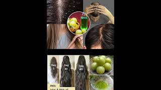 Amla powder for hair growth haircare adivasihairoil amlapowder hairgrowth shorts ytshorts [upl. by Cherianne]