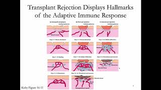 Immunology Lecture 32 Transplantation Immunology [upl. by Imarej820]