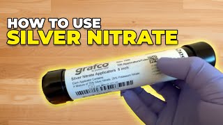 How to use silver nitrate [upl. by Kris]