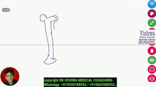 osteomyelitis pathology digital whiteboard sequestrum involucrum BY DRVISHWA MEDICAL 919930788955 [upl. by Asilim]