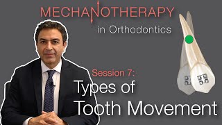 Mechanotherapy in Orthodontics Types of Tooth Movement Pt 1 [upl. by Sirac]