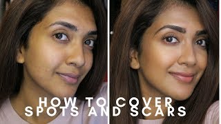 HOW TO COVER SPOTS AND SCARS  Vithya Hair and Makeup [upl. by Acinaj827]