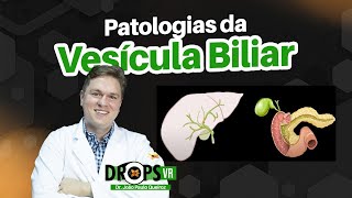 OS EXAMES MAIS IMPORTANTES PARA PATOLOGIAS DA VESÍCULA BILIAR I VOCÊ RADIOLOGISTA [upl. by Orabel]