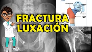 COMO EVALUAR UNA RADIOGRAFÍA DE CADERA [upl. by Eimat232]