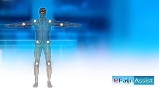 Fibromyalgia Explained Learn About 11 Tender Points Symptoms Causes of Fibromyalgia [upl. by Aroel393]